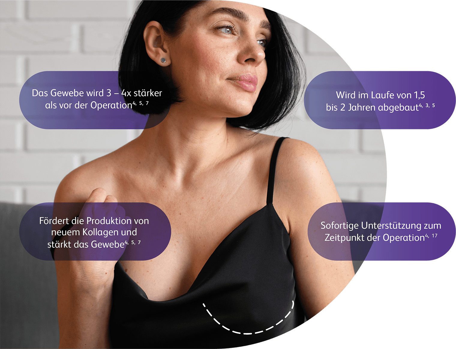 GalaFLEX Scaffold präklinische Daten - wissenschaftliche Studien und Langzeitergebnisse des Inneren BH